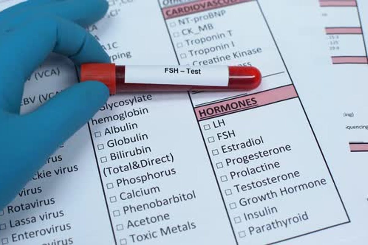 BioMarkers-Lab-Results